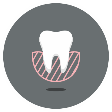 <p>The cone beam computer tomography (CT) is a special type of x-ray machine used in situations where regular dental or facial x-rays are not sufficient. The machine uses a special type of technology to generate three dimensional (3-D) images of dental structures, soft tissues, nerve paths and bone areas in the craniofacial region in a single scan. Images obtained with cone beam CT allow more precise treatment or surgical planning of impacted teeth, the diagnosis of jaw joint problems, the evaluation of bone disorders such as cysts, tumors, fractures. Using special software a surgical guide can be constructed based also on data received by intraoral scanners, useful in implantology or reconstructive surgery. The digital smile design, the cephalometric analysis and others applications are based on CBCT data.</p>